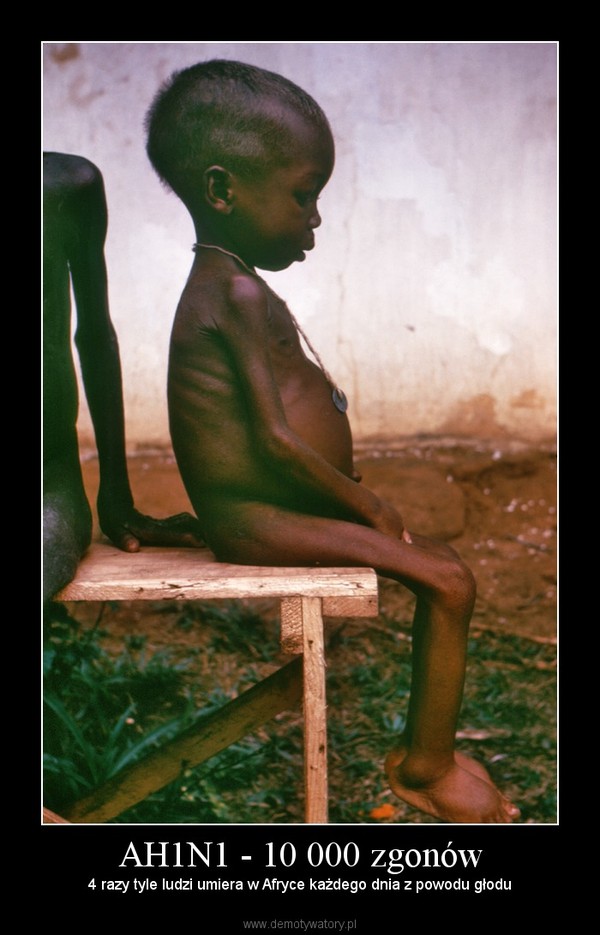 AH1N1 - 10 000 zgonów – 4 razy tyle ludzi umiera w Afryce każdego dnia z powodu głodu 