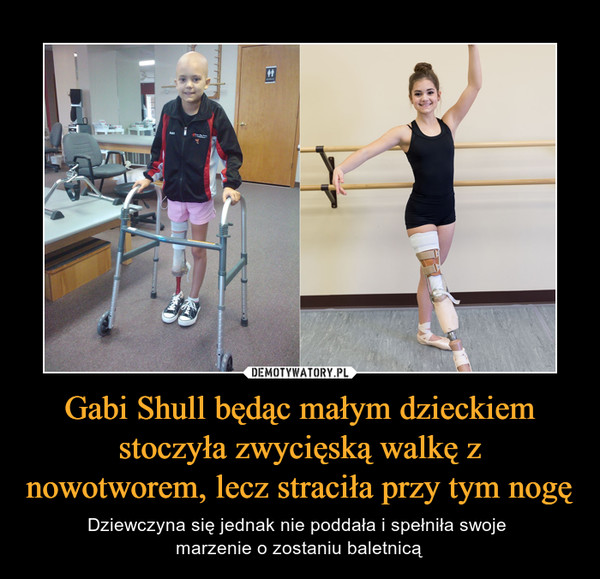 Gabi Shull będąc małym dzieckiem stoczyła zwycięską walkę z nowotworem, lecz straciła przy tym nogę