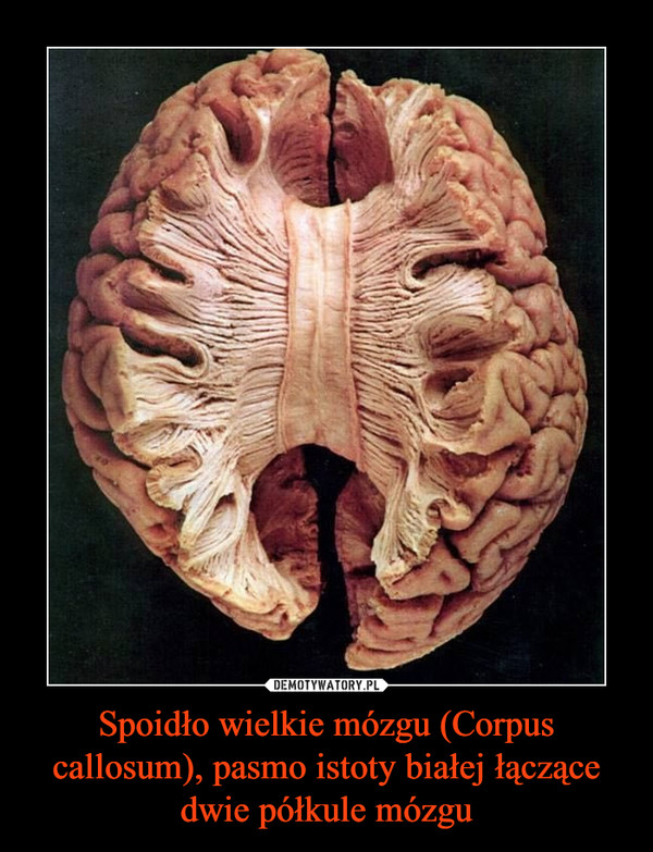 Spoidło wielkie mózgu (Corpus callosum), pasmo istoty białej łączące dwie półkule mózgu