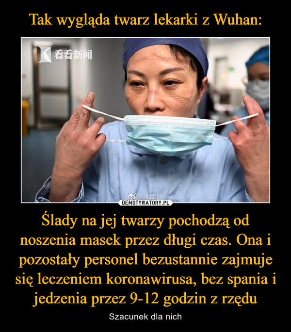 Tak wygląda twarz lekarki z Wuhan: Ślady na jej twarzy pochodzą od noszenia masek przez długi czas. Ona i pozostały personel bezustannie zajmuje się leczeniem koronawirusa, bez spania i jedzenia przez 9-12 godzin z rzędu