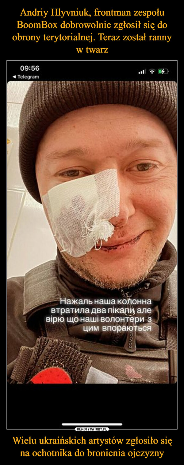 Andriy Hlyvniuk, frontman zespołu BoomBox dobrowolnie zgłosił się do obrony terytorialnej. Teraz został ranny w twarz Wielu ukraińskich artystów zgłosiło się na ochotnika do bronienia ojczyzny