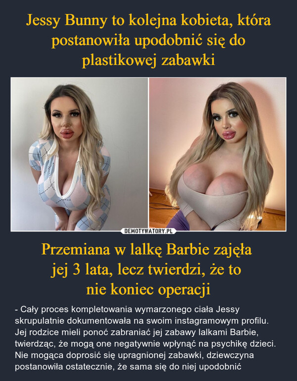 Przemiana w lalkę Barbie zajęła jej 3 lata, lecz twierdzi, że to nie koniec operacji – - Cały proces kompletowania wymarzonego ciała Jessy skrupulatnie dokumentowała na swoim instagramowym profilu. Jej rodzice mieli ponoć zabraniać jej zabawy lalkami Barbie, twierdząc, że mogą one negatywnie wpłynąć na psychikę dzieci. Nie mogąca doprosić się upragnionej zabawki, dziewczyna postanowiła ostatecznie, że sama się do niej upodobnić 