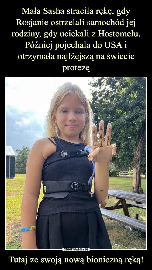 Mała Sasha straciła rękę, gdy Rosjanie ostrzelali samochód jej rodziny, gdy uciekali z Hostomelu. Później pojechała do USA i otrzymała najlżejszą na świecie protezę Tutaj ze swoją nową bioniczną ręką!